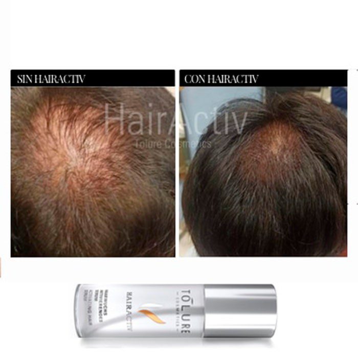 Tolure HairActiv 100 ml