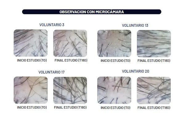 Kit Growth Capilar Hissys Technologies